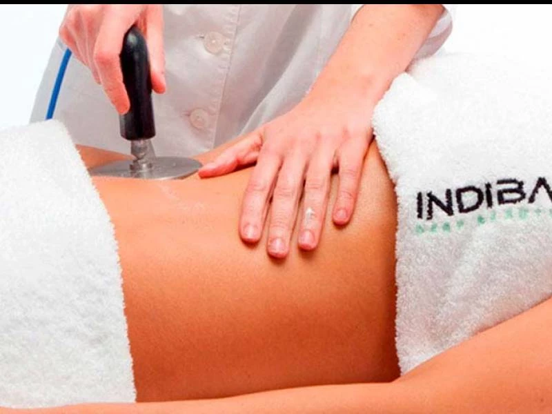 Tratamiento Indiba en Boadilla del Monte