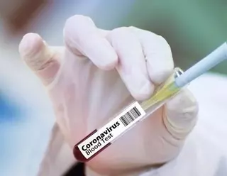 Continúa aumentando el número de casos de coronavirus en Villanueva de la Cañada y Villanueva del Pardillo