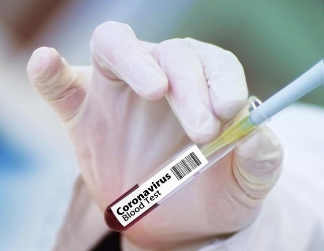 Continúa aumentando el número de casos de coronavirus en Villanueva de la Cañada y Villanueva del Pardillo