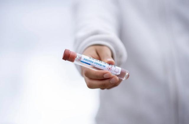 Desciende la tasa de contagio por coronavirus en Villanueva de la Cañada y Villanueva del Pardillo