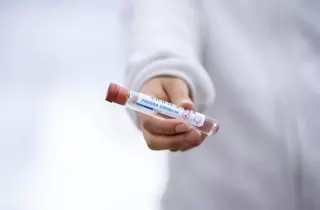Desciende la tasa de contagio por coronavirus en Villanueva de la Cañada y Villanueva del Pardillo